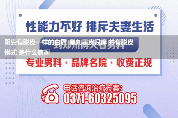 阴囊有脱皮一样的白屑_睾丸表皮很痒 并有脱皮模式 是什么病啊